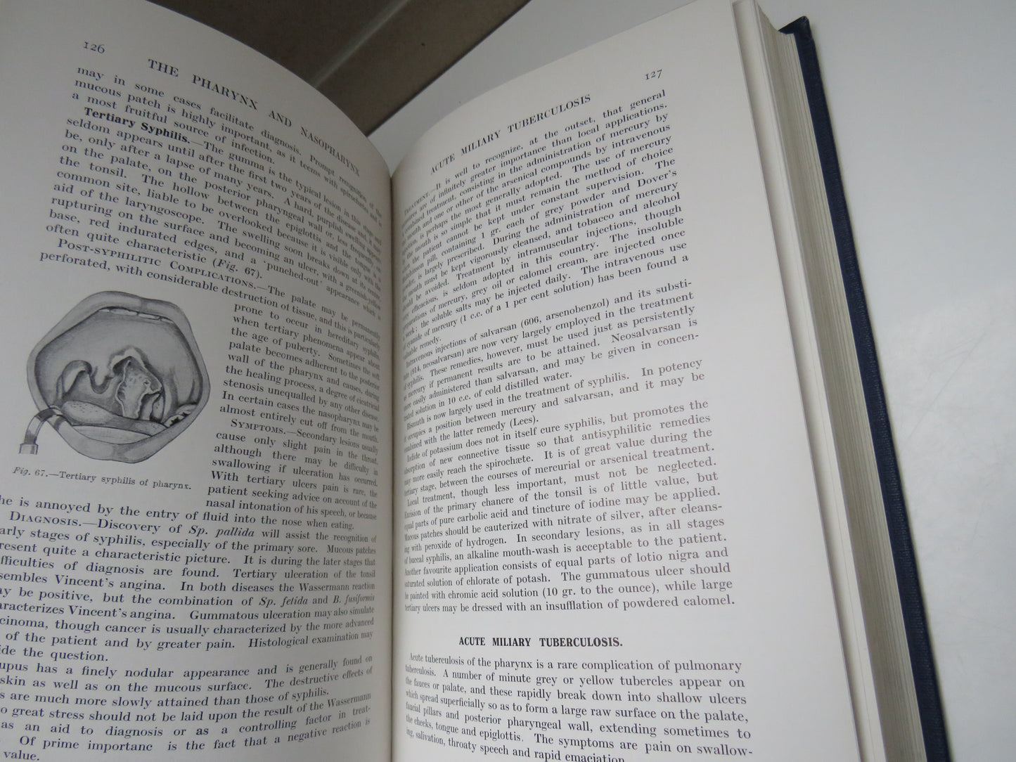 Diseases of the Nose, Throat and Ear For Practitioners and Students Edited By A. Logan Turner 1936