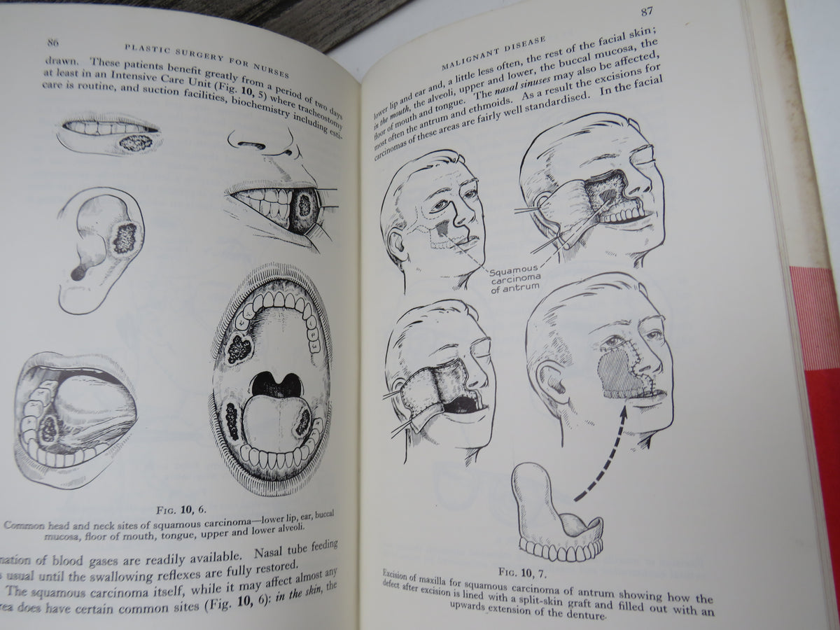 Plastic Surgery For Nurses By Ian A. McGregor and Wm. Henry Reid 1966 Author signed book image 6