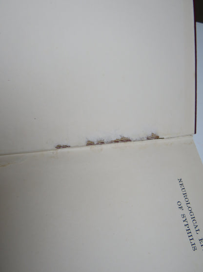 Neurological Effects of Syphilis, Diagnosis and Treatment by B. Buckley Sharp, 1933 book image 3