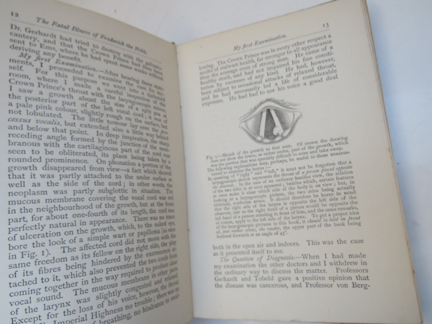 The Fatal Illness of Frederick The Noble by Morell MacKenzie, 1888