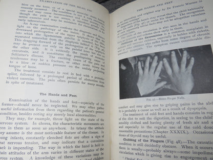 The Clinical Study and Treatment of Sick Children By John Thomson 1921