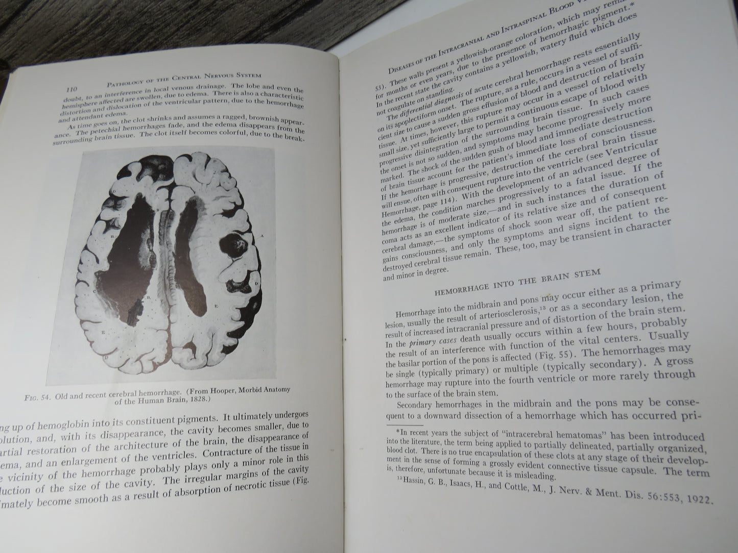 Pathology of the Central Nervous System By Cyril B. Courville 1945
