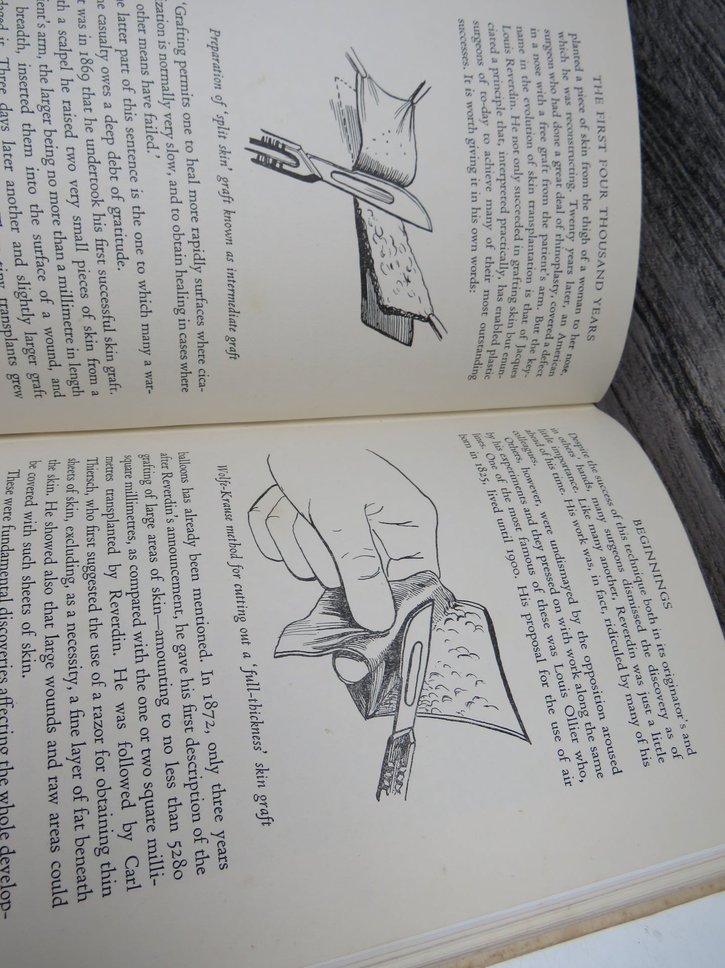 The Story of Plastic Surgery By George Bankoff 1952