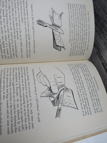 The Story of Plastic Surgery By George Bankoff 1952