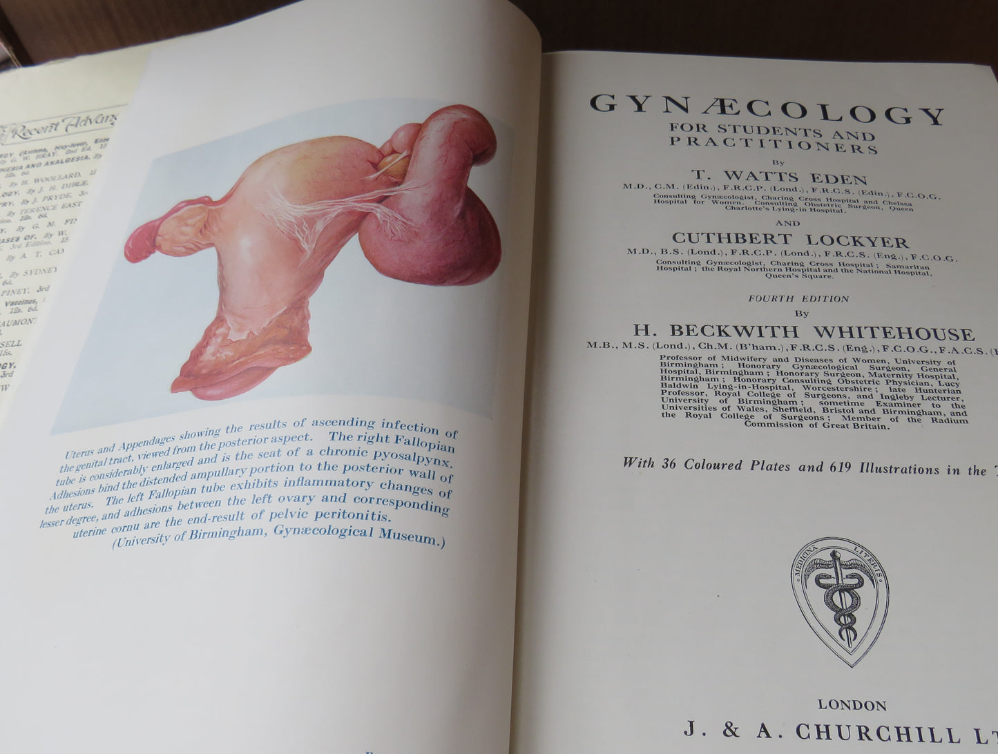 Eden and Lockyer's Gynaecology For Students And Practitioners, 1935